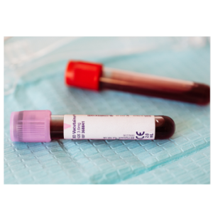 Blood vials